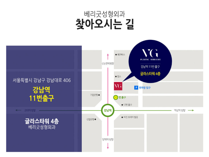 부유방, 팔 지방흡입 베리굿성형외과에서 모델같은 몸매! 관련 이미지 10