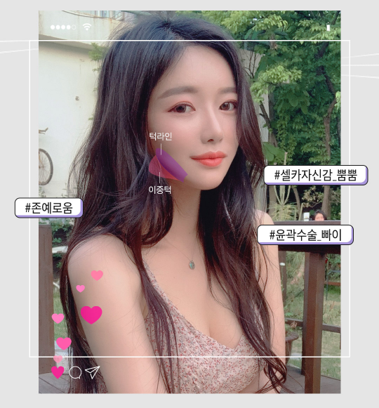 얼굴지방흡입비용 갸름한 얼굴라인을 원한다면? 관련 이미지 4