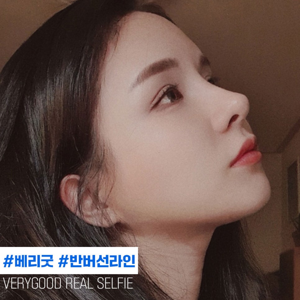 수능끝! 예쁨시작👀❤ 베리굿성형외과 코성형 관련 이미지 4