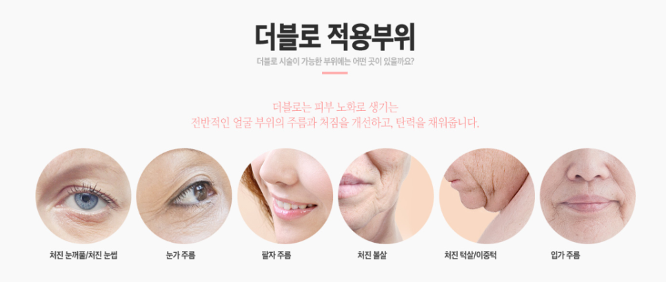 더블로 골드 리프팅으로 나이는 낮추고 탄력은 높이자! 관련 이미지 3