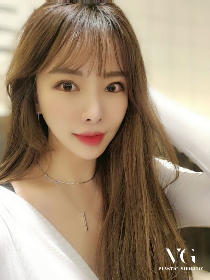 깊은 이마주름 베리굿성형외과에서 매끈하게! 관련 이미지 1