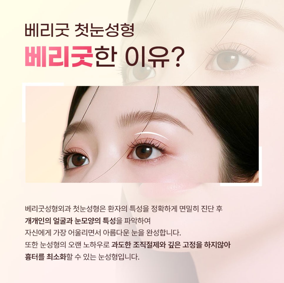 쌍꺼풀&middot;트임&middot;눈매교정, 나에게 맞는 눈성형 조합은? 강남역눈성형병원 관련 이미지 1