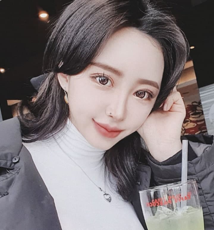 베리굿이 알려드리는 첫눈성형! (눈매교정) 관련 이미지 1