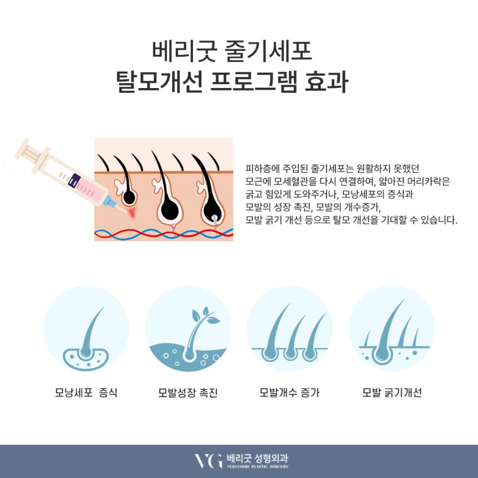 강남 베리굿성형외과 , 줄기세포 시술로 피부 안티에이징부터 탈모 치료효과까지 관련 이미지 5