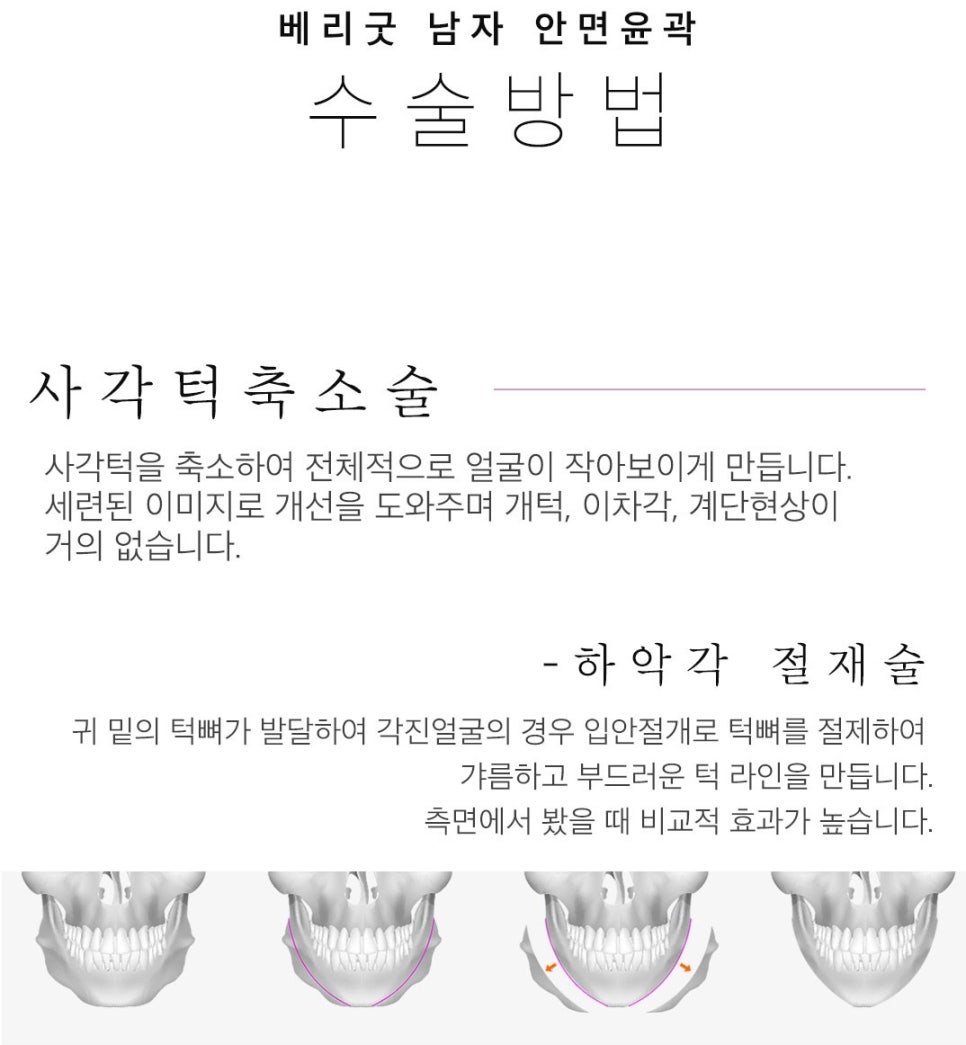 자연스러운 얼굴 라인~베리굿 남자 안면윤곽 관련 이미지 3