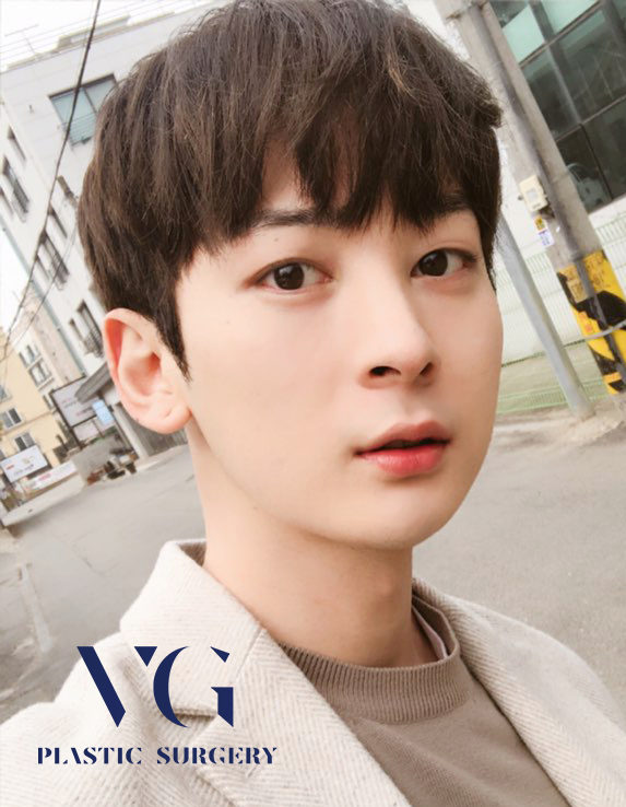 남자눈매교정전후 확실하게 관련 이미지 1