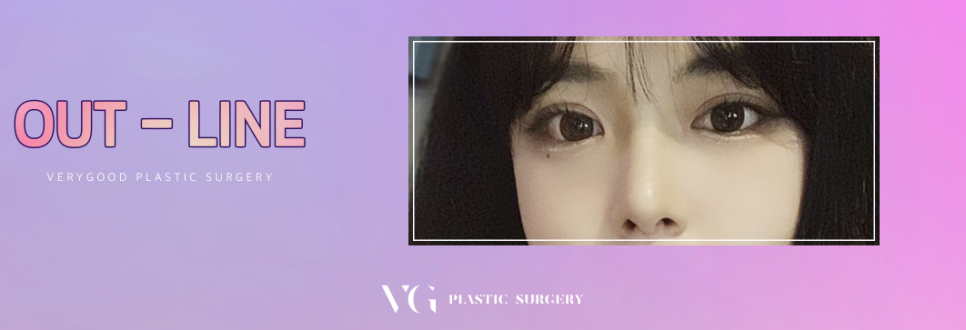 베리굿 눈매교정으로 졸려보이는 안검하수 탈출~! 관련 이미지 1