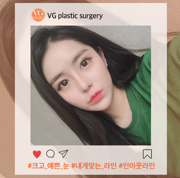 강남쌍꺼풀 수술 잘하는곳 실패없이 고르자 관련 이미지 1