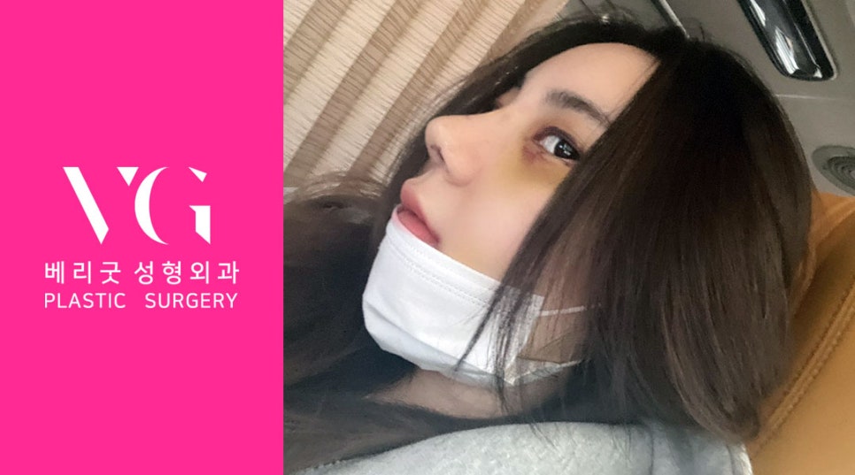 베리굿 안면윤곽💖어디서 봐도 VERY GOOD✨ 관련 이미지 2