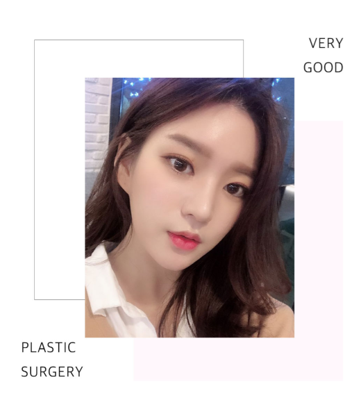 베리굿 눈재수술로 마지막을 완성하다! 관련 이미지 8