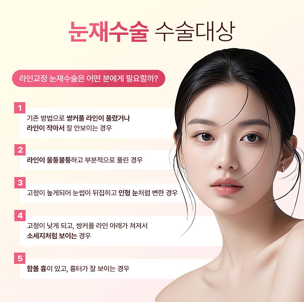 Gangnam Station Revision Eyelid Surgery, Why Analyzing Your Current Eye Condition Comes First image 2