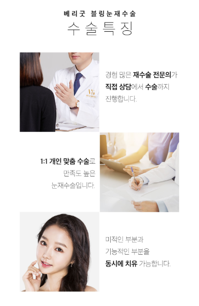 베리굿 눈재수술로 마지막을 완성하다! 관련 이미지 9