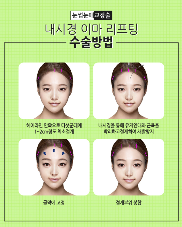 이마거상으로 어리고 또렷한 인상으로~ 관련 이미지 3