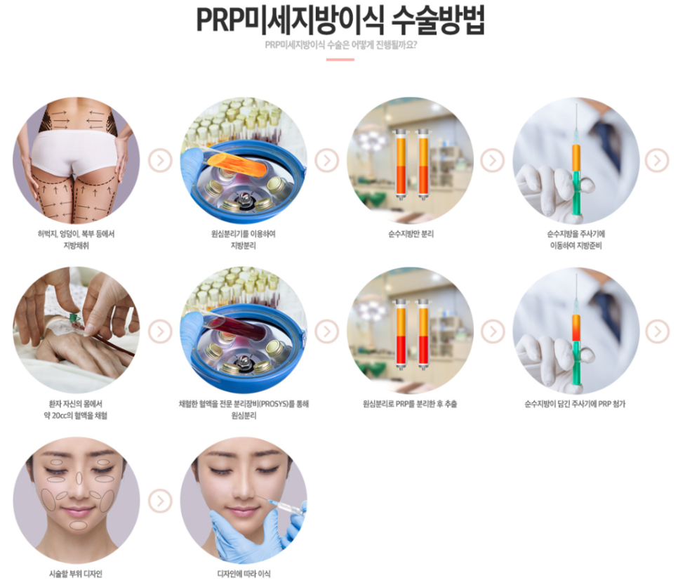 얼굴지방이식으로 내게 어울리는 디자인으로 관련 이미지 3