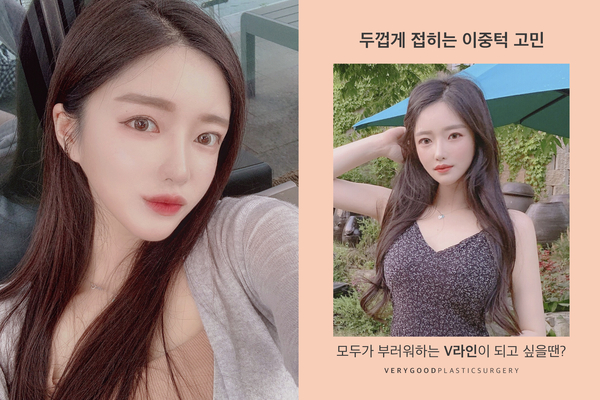 얼굴지방흡입으로 이중턱 박살내자! 관련 이미지 1