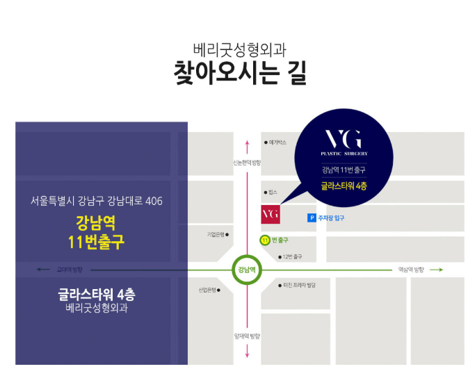 풀페이스리프팅 베리굿성형외과에서 동안얼굴 완성~! 관련 이미지 14