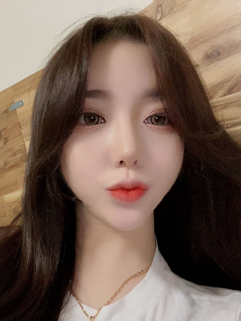 처진피부 슈링크 만으로 탱탱해질까? 관련 이미지 3