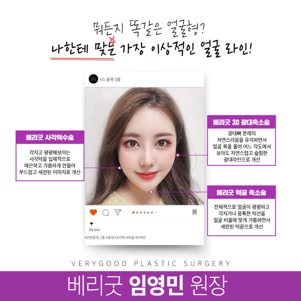 빛나는 나의 선택! 베리굿 안면윤곽 수술😍 관련 이미지 2