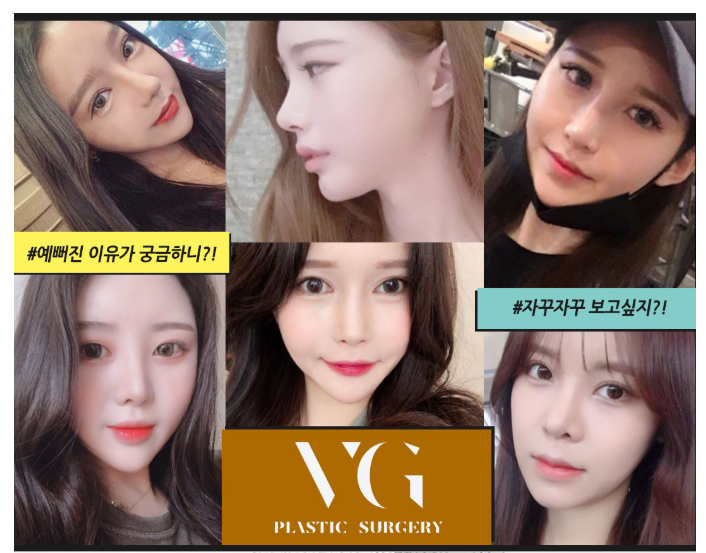 베리굿성형외과 프리미엄 가슴확대! 임영민원장님 기대해봐요! 관련 이미지 13