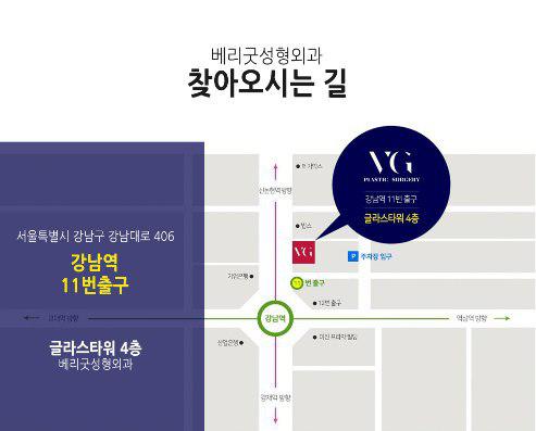 자가 늑연골 코재수술로 완벽해지자! 관련 이미지 12