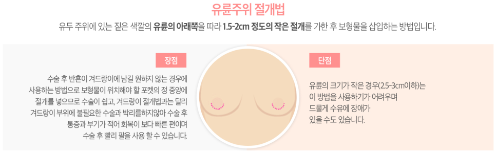 베리굿성형외과 보여줄게, 가진 자의 여유! 프리미엄 가슴확대술 관련 이미지 6