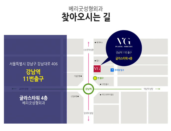 베리굿성형외과, 엑설런트 코성형! 임영민원장님의 노하우! 관련 이미지 11