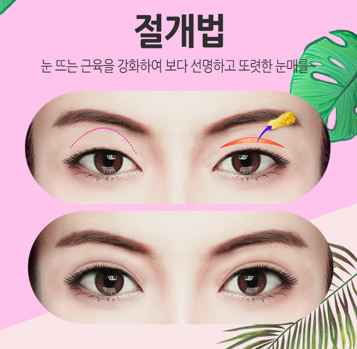 눈성형잘하는곳 내게 맞는 눈매라인에 맞게 관련 이미지 8