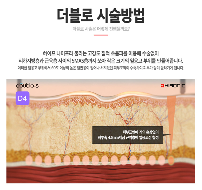 더블로리프팅 처진피부를 탱탱하게! 관련 이미지 4