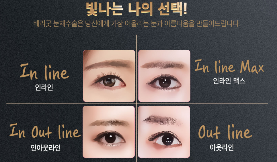 마지막은 쌍수는 베리굿에서 블링블링하게 베리굿 눈재수술전후👀✨ 관련 이미지 2