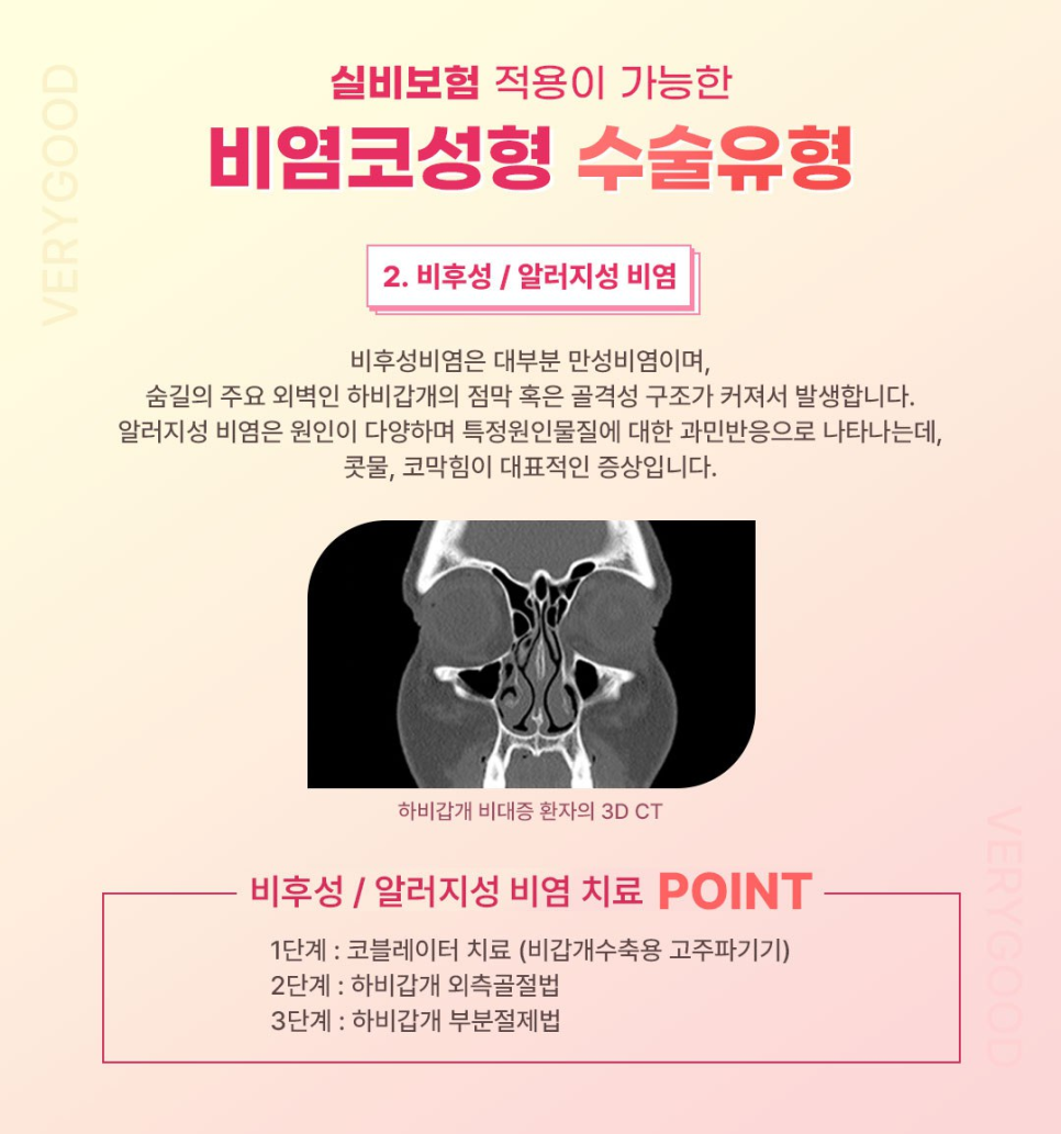 콧물&middot;코막힘&middot;재채기&hellip;비염도 치료하고 코모양도 예뻐지고 싶다면? 강남 비염코성형 관련 이미지 5