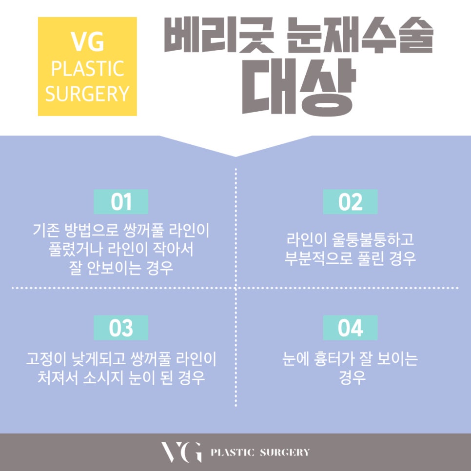 베리굿에서 눈재수술하고 이전보다 아름답게! 관련 이미지 5