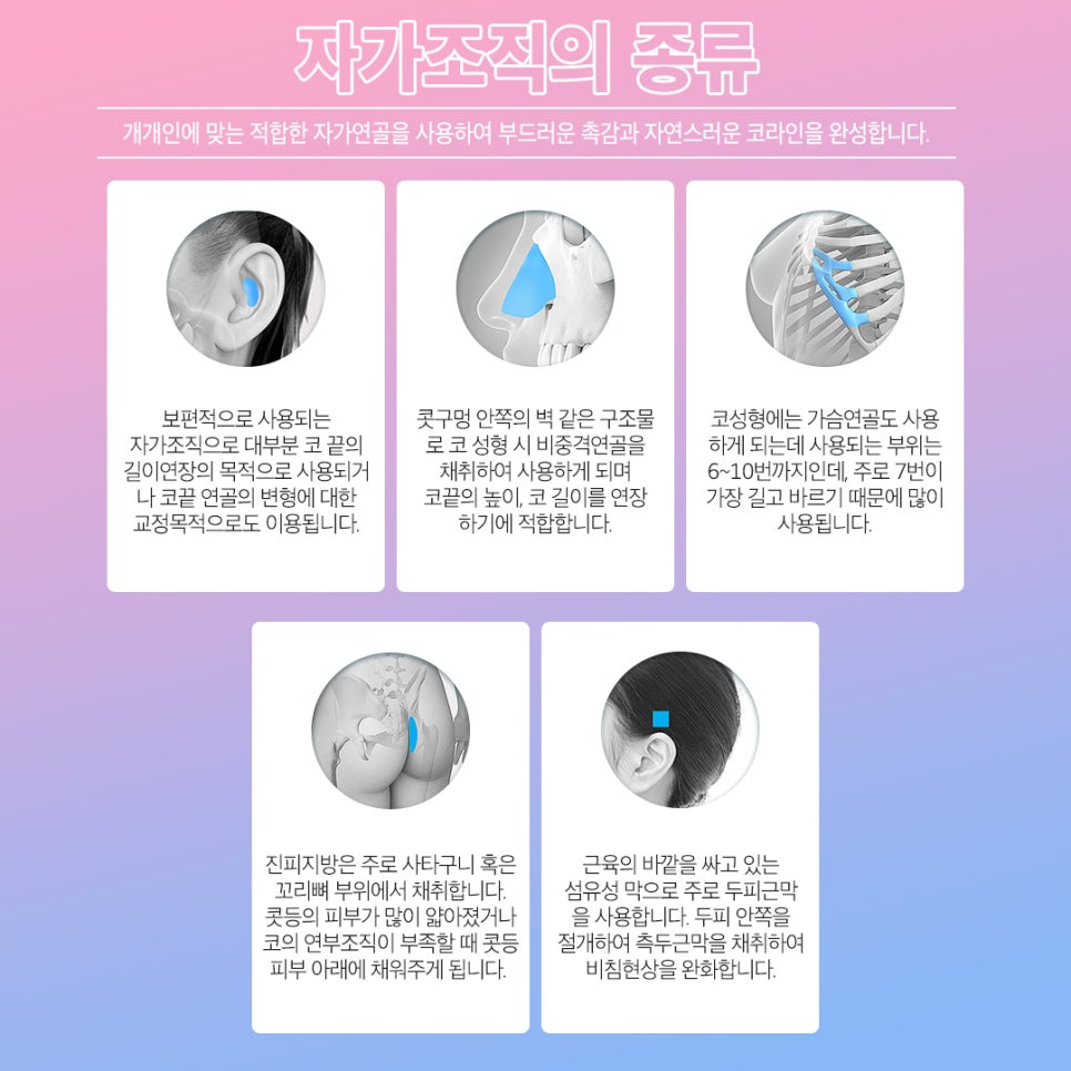 자가늑연골 코성형의 모든것 (코재수술 2탄!) 관련 이미지 4