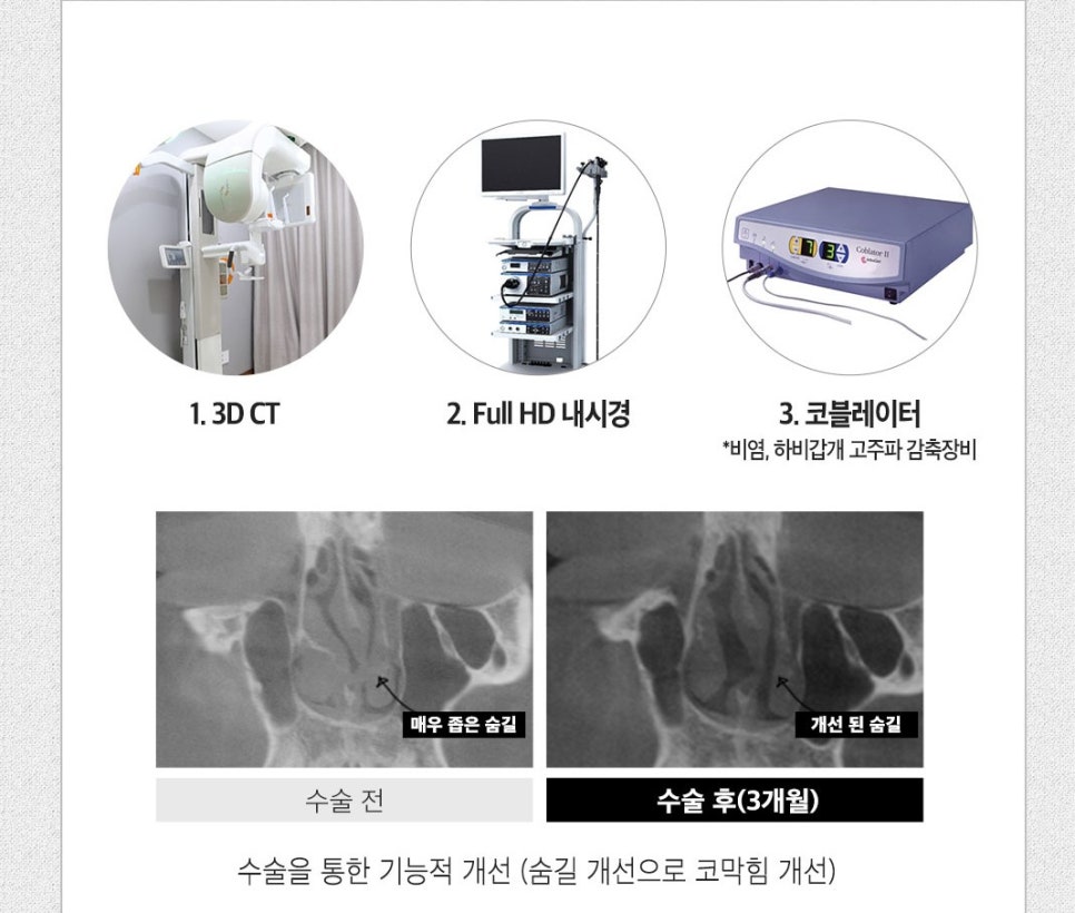 마지막 코재수술은 베리굿에서~ 관련 이미지 5