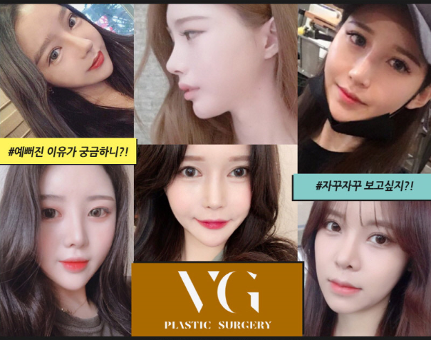 부드러운 촉감에 자연스러운 가슴성형을 찾는다면 베리굿성형외과로! 관련 이미지 15