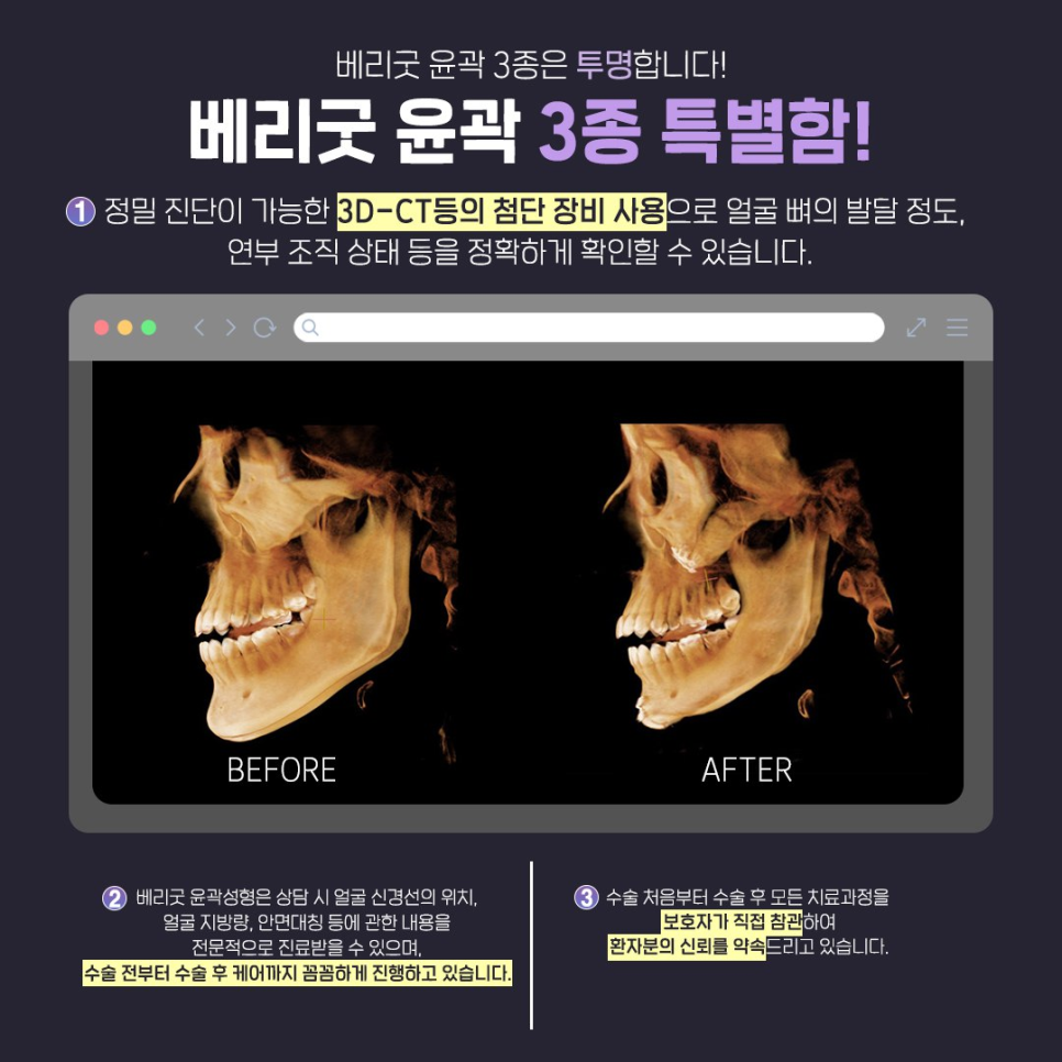 사각턱&middot;광대&middot;턱끝, 강남역 안면윤곽 3종으로 완성하는 황금비율 얼굴 관련 이미지 5