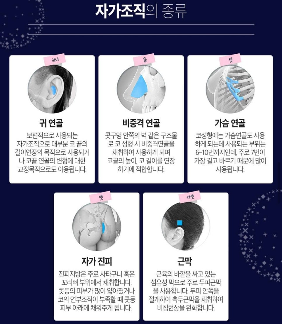 남자코성형,남자코성형가격, 관련 이미지 4