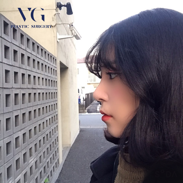 매부리코, 코성형 유형에 맞게 수술하자 관련 이미지 3