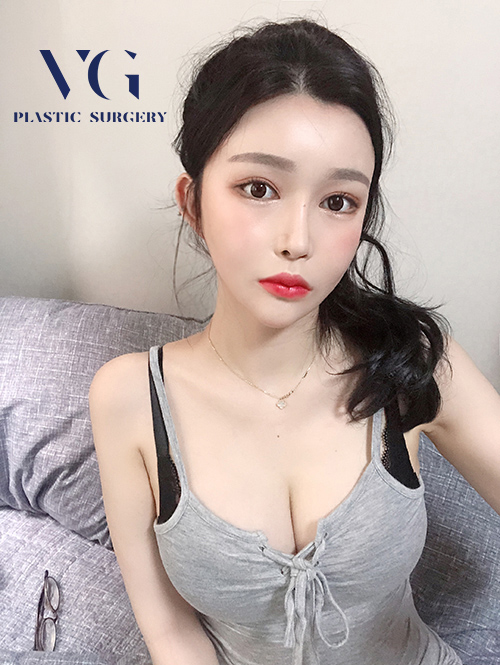 가슴성형비용 자연스러운 움직임과 촉감으로 관련 이미지 1