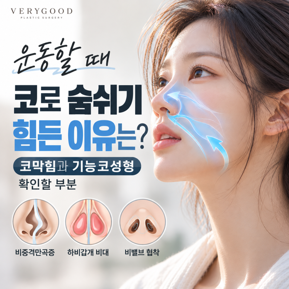 코막힘이 운동할 때 더 심해진다면? 숨쉬기 불편한 코와 기능코성형 관련 이미지 1
