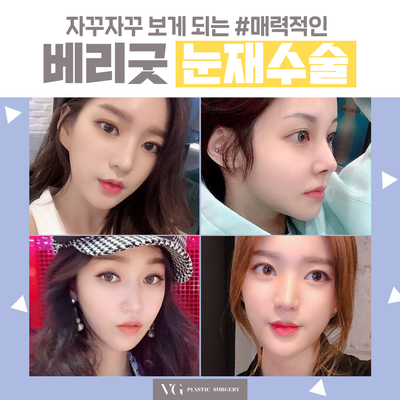 성공적인 눈재수술을 위한 포인트! 관련 이미지 4