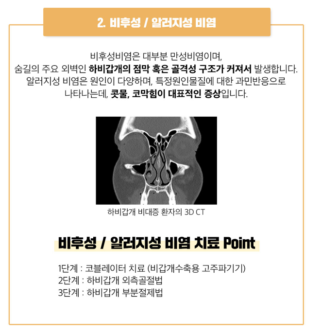베리굿 비염코성형❤기능과 미용을 동시에?!😍 관련 이미지 6