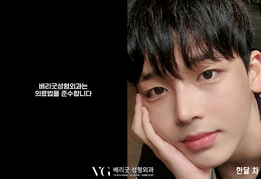 낮은 콧대 모여라❣❣ 베리굿 코끝성형으로 예뻐지자✨ 관련 이미지 6