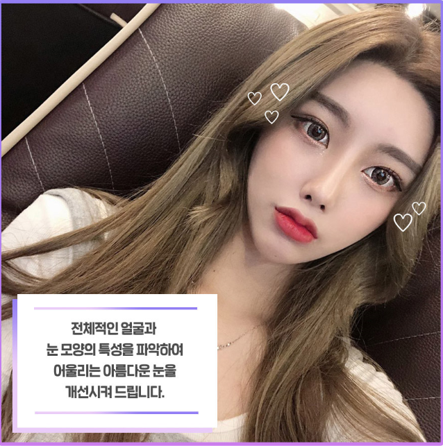 쌍꺼풀수술 비용부터 수술방법까지 관련 이미지 5