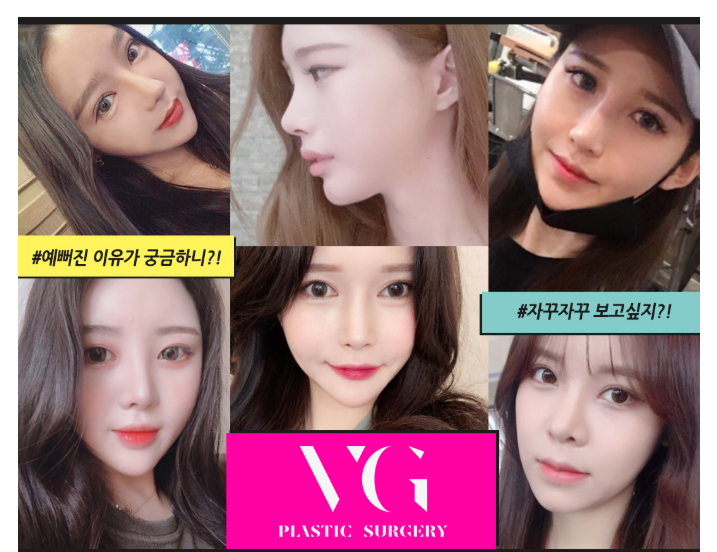 말랑말랑, 촉감이 다른 베리굿성형외과 벨라젤 가슴성형! 강남역성형외과 임영민 원장님 관련 이미지 10