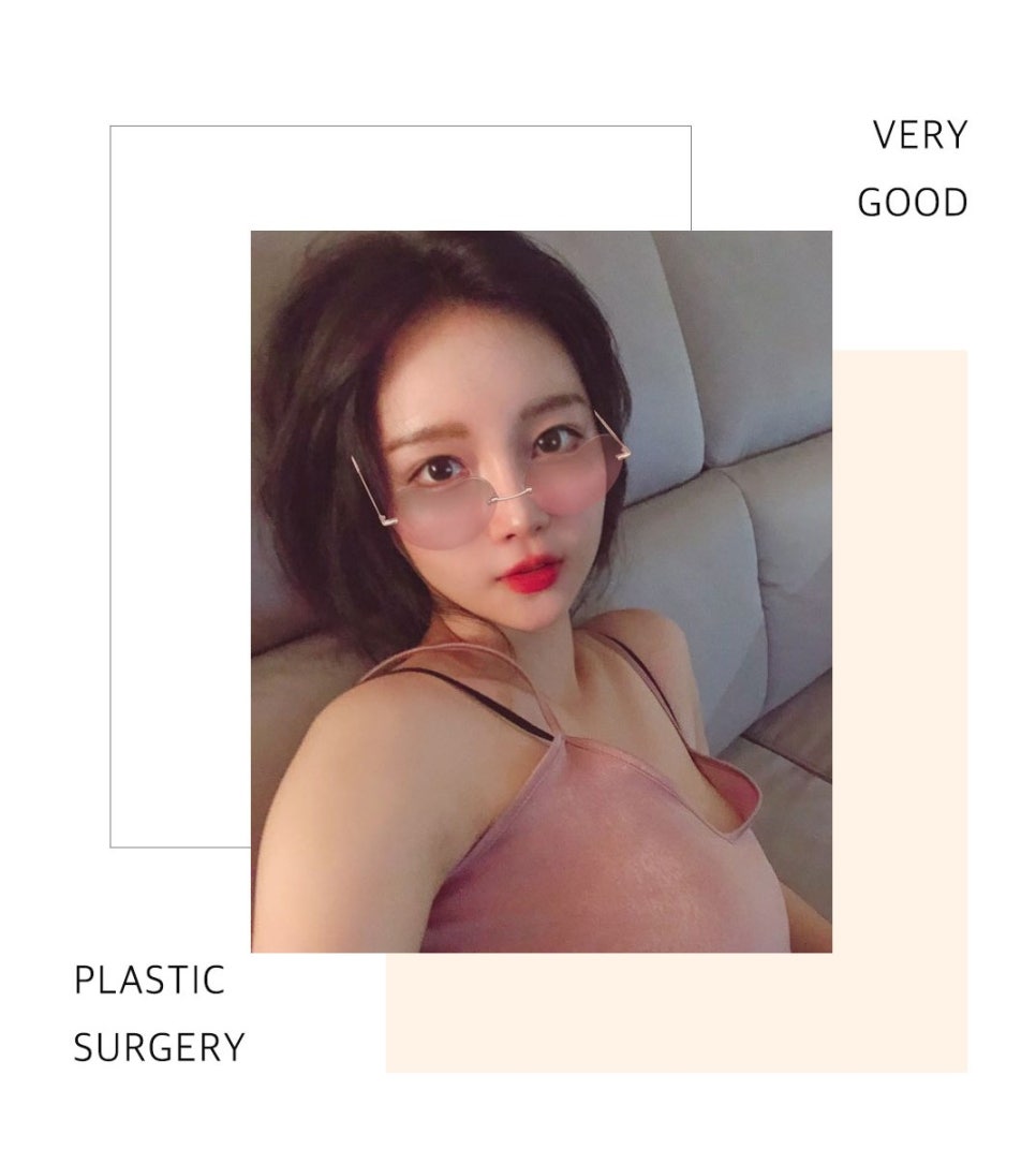 마지막 눈재수술-실패없는 선택 관련 이미지 4