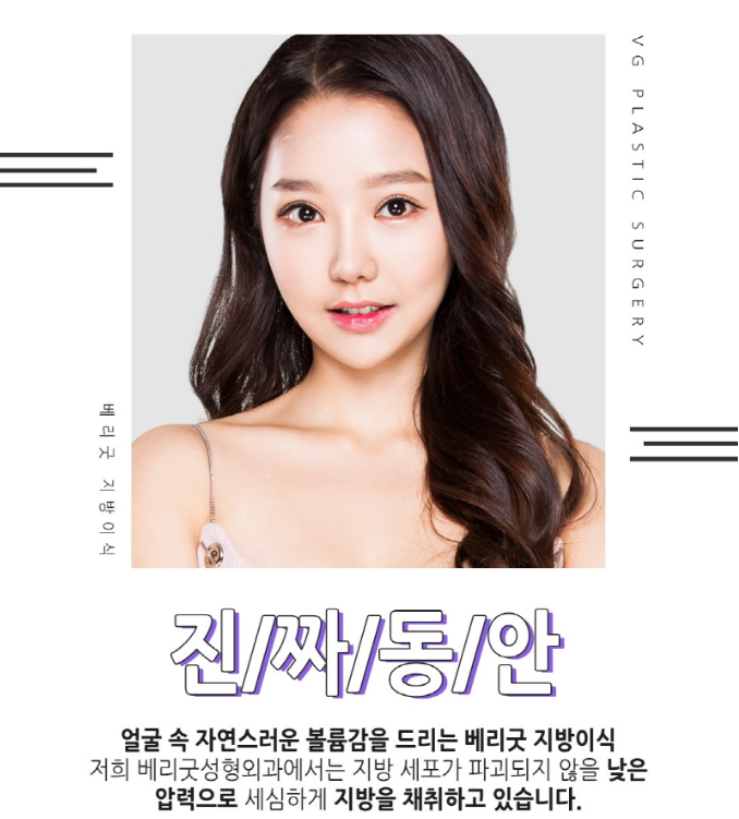 지방이식잘하는곳 입체적으로 아름답게! 관련 이미지 3