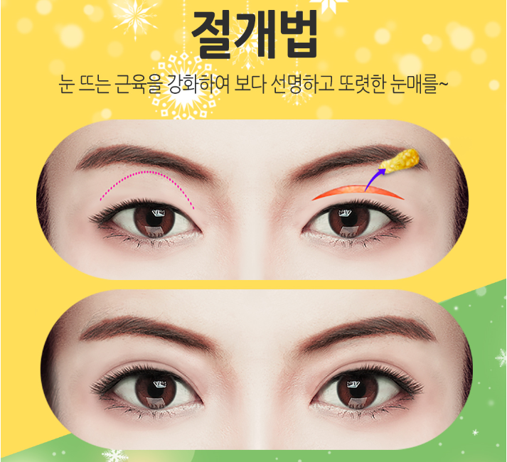 베리굿성형외과 관련 이미지 8