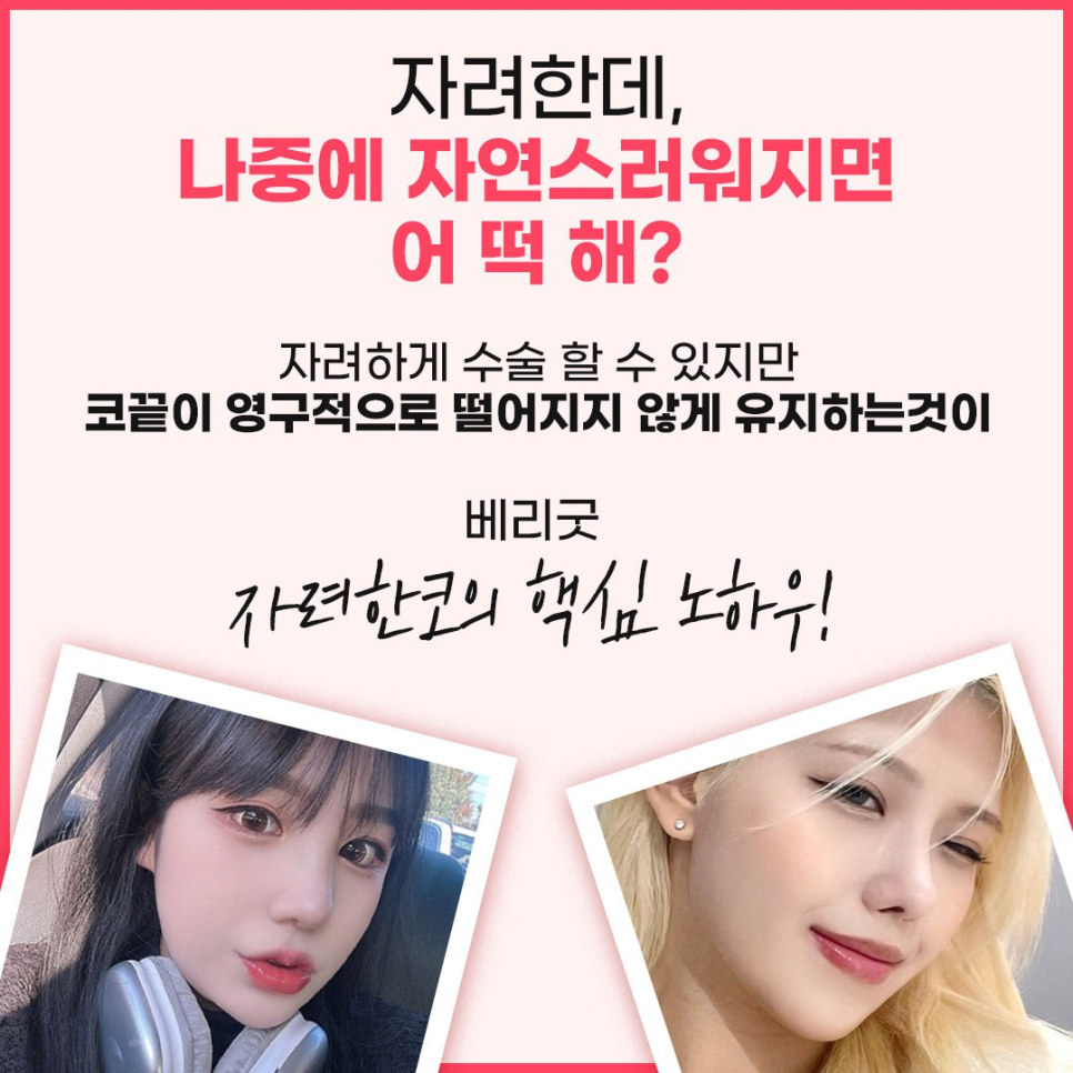 코재수술 원인 및 병원선택 어떻게 해야될까 , 강남코재수술성형외과 관련 이미지 4