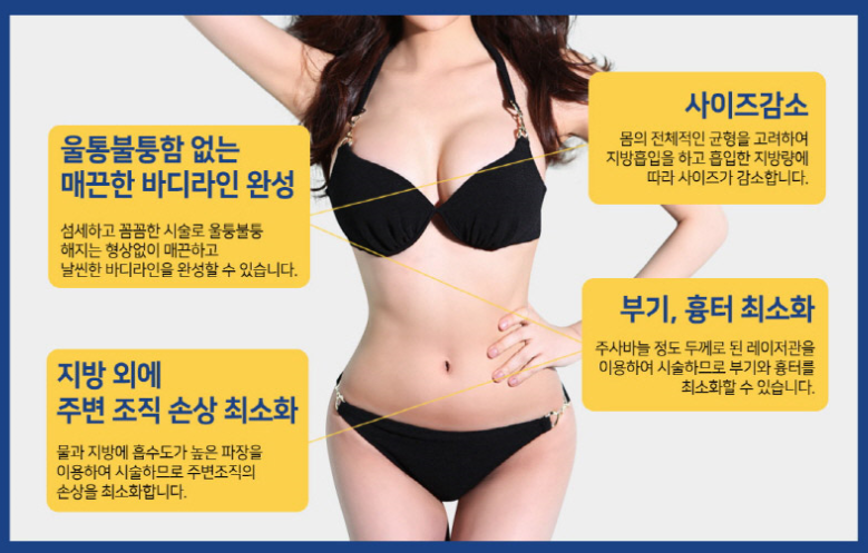 팔뚝 / 부유방 지방흡입으로 여름준비시작! 관련 이미지 3