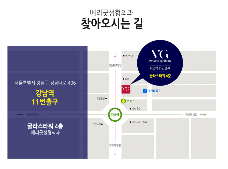 코재수술 베리굿성형외과! 엑설런트~! 임영민원장님 관련 이미지 13